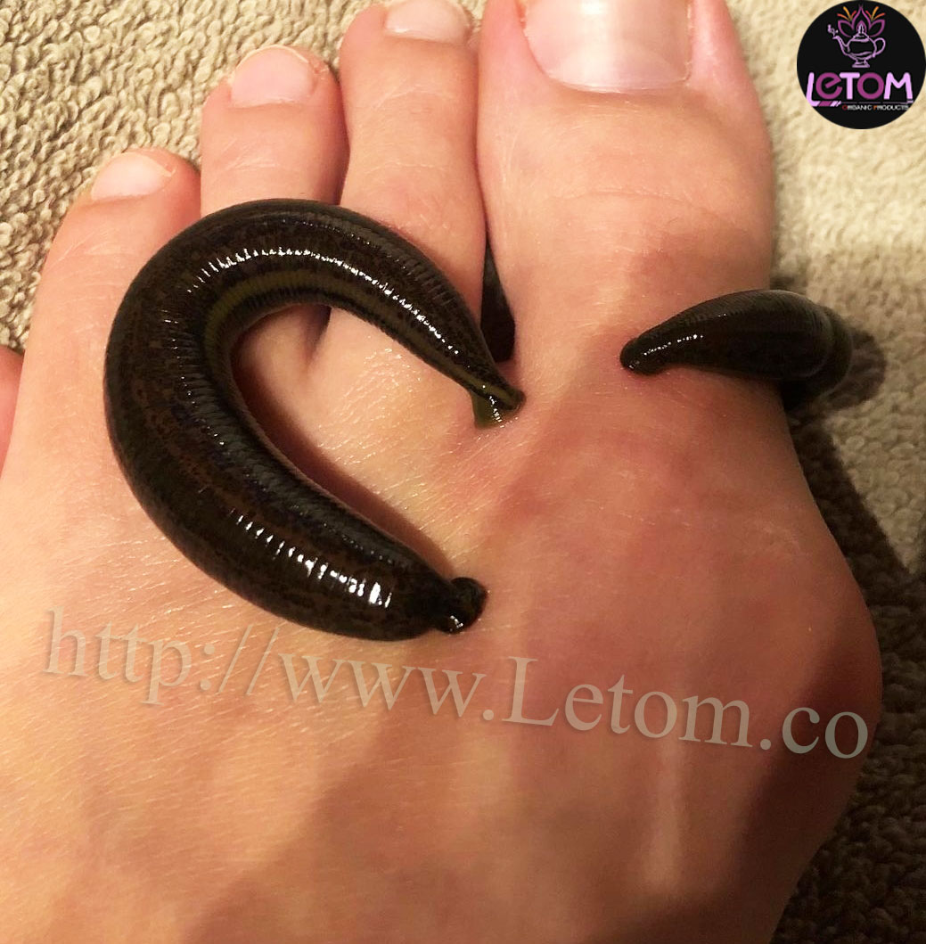 A photo of a leech on its leg and its effect on cleansing the body